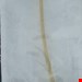 سوند فولی لاتکس سایز ۸ انتی باکتریال بکتیگارد ساخت سوئد دارای پوشش طلا و نقره و پالدیوم که باعث کاهش خطر بروز عفونت در نوزادان و اطفال بامشکل ادراری استفاده میشود  