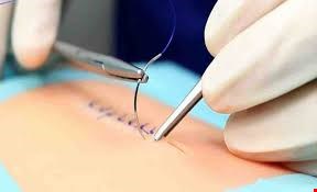 فوم آموزش دوخت بخیه جهت تمرین کردن کادر درمانی با انواع نخ بخیه در دوختن انواع روش های بخیه زدن کاربرددارد. بافت نرم شبیه پوست بدن است.